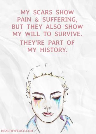 Citat mentalne bolesti - Moji ožiljci pokazuju bol i patnju, ali pokazuju i moju volju za preživljavanjem. Oni su dio moje povijesti.