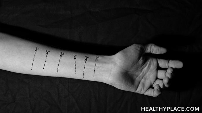 Ljudi koji sakrivaju ožiljke od samopovrede osjećaju krivnju i sram. Ne mora to biti ovako. Naučite kako razgovarati o ožiljcima od samoozljeđivanja.