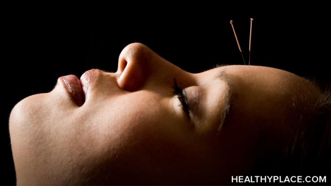 NIH panel zaključuje da je učinkovitost akupunkture u liječenju kronične boli, fibromijalgije i drugih stanja još uvijek u zraku.